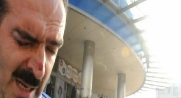 MUSTAFA AKBABA HDP EYLEMLERİ SIRASINDA YARALANDI